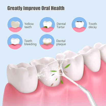 Irrigador Oral Portátil, Floss Dental com Jato de Água Recarregável por USB, 4 Pontas de Jato, 220ml, 3 Modos, IPX7, 1400rpm.
