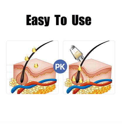 Pente Aplicador de Couro Cabeludo, Mini Pente Portátil de Massagem, Massageador Guiador de Líquido para Óleo Essencial, Anti-Queda de Cabelo, Ferramentas de Cuidados com o Couro Cabeludo.